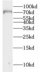 Western Blot: MUC20 Antibody - BSA Free [NBP3-46995] - Human liver tissue were subjected to SDS PAGE followed by western blot with (MUC20 antibody) at dilution of 1:400