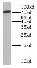 Western Blot: MTO1 Antibody - BSA Free [NBP3-47001] - Human liver tissue were subjected to SDS PAGE followed by western blot with (MTO1 antibody) at dilution of 1:500