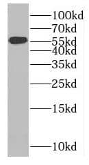 Western Blot MTMR8 Antibody - BSA Free