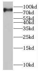 Western Blot MTMR7 Antibody - BSA Free
