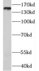 Western Blot: MTMR3 Antibody - BSA Free [NBP3-47005] - SW 1990 cells were subjected to SDS PAGE followed by western blot with ( MTMR3 Antibody) at dilution of 1:300