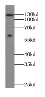 Western Blot: MTMR15 Antibody - BSA Free [NBP3-47006] - HeLa cells were subjected to SDS PAGE followed by western blot with (MTMR15 antibody) at dilution of 1:500