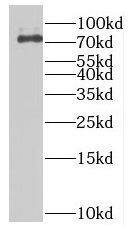 Western Blot MTMR12 Antibody - BSA Free