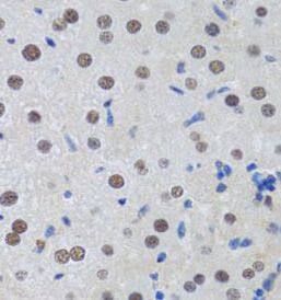 Immunohistochemistry MTA3 Antibody - BSA Free