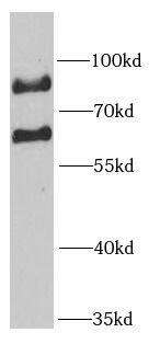 Western Blot MTA3 Antibody - BSA Free