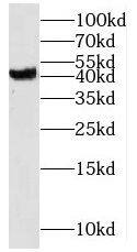 Western Blot: MS4A6A Antibody - BSA Free [NBP3-47016] - K-562 cells were subjected to SDS PAGE followed by western blot with (MS4A6A antibody) at dilution of 1:400