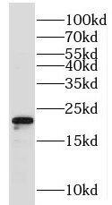 Western Blot: MRPS28 Antibody - BSA Free [NBP3-47020] - Human placenta tissue were subjected to SDS PAGE followed by western blot with (MRPS28 antibody) at dilution of 1:400