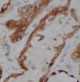 Immunohistochemistry MRPS17 Antibody - BSA Free