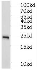 Western Blot: MRPS10 Antibody - BSA Free [NBP3-47029] - Human brain tissue were subjected to SDS PAGE followed by western blot with (MRPS10 antibody) at dilution of 1:500