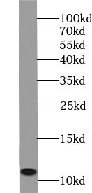 Western Blot: MRPL53 Antibody - BSA Free [NBP3-47032] - A549 cells were subjected to SDS PAGE followed by western blot with (MRPL53 Antibody) at dilution of 1:500