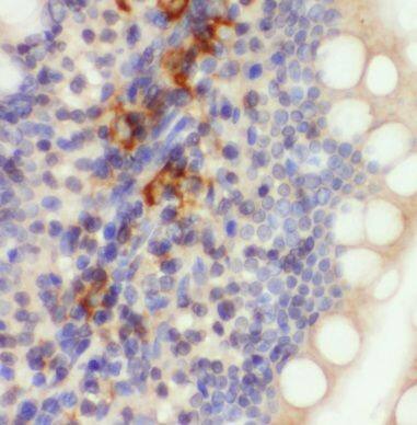 Immunohistochemistry MRPL47 Antibody - BSA Free