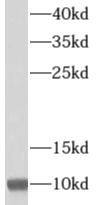 Western Blot: MRPL34 Antibody - BSA Free [NBP3-47038] - Human liver tissue were subjected to SDS PAGE followed by western blot with (MRPL34 antibody) at dilution of 1:2000