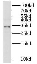 Western Blot: MRPL2 Antibody - BSA Free [NBP3-47045] - Human liver tissue were subjected to SDS PAGE followed by western blot with (MRPL2 antibody) at dilution of 1:500