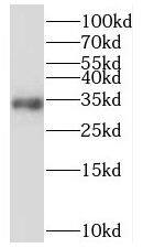 Western Blot: MRPL15 Antibody - BSA Free [NBP3-47046] - MCF7 cells were subjected to SDS PAGE followed by western blot with (MRPL15 antibody) at dilution of 1:1000