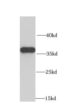 Western Blot: MRPL1 Antibody - BSA Free [NBP3-47050] - Human liver tissue were subjected to SDS PAGE followed by western blot with (MRPL1 antibody) at dilution of 1:1000