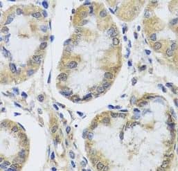Immunohistochemistry: MRPL1 Antibody - BSA Free [NBP3-47050] - Immunohistochemistry of paraffin-embedded human stomach tissue slide using (MRPL1 Antibody) at dilution of 1:50