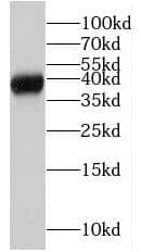 Western Blot: MRM1 Antibody - BSA Free [NBP3-47051] - MCF-7 cells were subjected to SDS PAGE followed by western blot with ( MRM1 Antibody) at dilution of 1:300