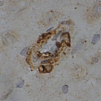 Immunohistochemistry: MRAP2 Antibody - BSA Free [NBP3-47053] - Immunohistochemistry of paraffin-embedded human brain using (MRAP2 antibody) at dilution of 1:50
