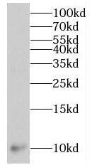 Western Blot MPV17L Antibody - BSA Free