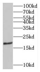 Western Blot MPV17 Antibody - BSA Free