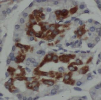 Immunohistochemistry MPV17 Antibody - BSA Free