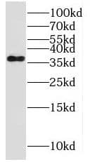 Western Blot: MPPED1 Antibody - BSA Free [NBP3-47059] - Mouse brain tissue were subjected to SDS PAGE followed by western blot with (MPPED1 antibody) at dilution of 1:1500