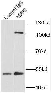 Immunoprecipitation: mpp8 Antibody - BSA Free [NBP3-47061] - IP Result of anti-mpp8 (IP:, 4ug; Detection: 1:1000) with mouse brain tissue lysate 4000ug.