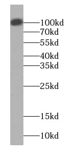 Western Blot: mpp8 Antibody - BSA Free [NBP3-47061] - Mouse brain tissue were subjected to SDS PAGE followed by western blot with (mpp8 antibody) at dilution of 1:1500