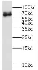 Western Blot MPP7 Antibody - BSA Free