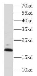 Western Blot: BRP44 Antibody - BSA Free [NBP3-47064] - Mouse brain tissue were subjected to SDS PAGE followed by western blot with (BRP44 antibody) at dilution of 1:1000