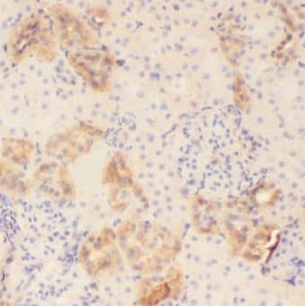 Immunohistochemistry: MOGAT2 Antibody - BSA Free [NBP3-47068] - Immunohistochemistry of paraffin-embedded human kidney using (MOGAT2 antibody) at dilution of 1:50