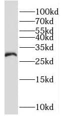 Western Blot MOGAT2 Antibody - BSA Free