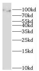 Western Blot: MOCOS Antibody - BSA Free [NBP3-47071] - HepG2 cells were subjected to SDS PAGE followed by western blot with (MOCOS antibody) at dilution of 1:300