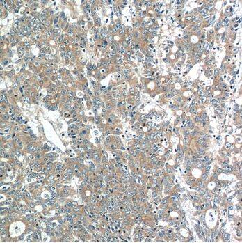 Immunohistochemistry MOBKL3 Antibody - BSA Free