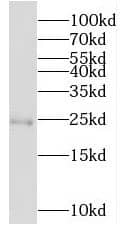 Western Blot: MOBKL3 Antibody - BSA Free [NBP3-47073] - K-562 cells were subjected to SDS PAGE followed by western blot with (MOBKL3 antibody) at dilution of 1:200