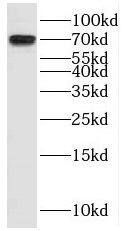 Western Blot: MAX binding protein Antibody - BSA Free [NBP3-47075] - HeLa cells were subjected to SDS PAGE followed by western blot with (MAX binding protein antibody) at dilution of 1:600
