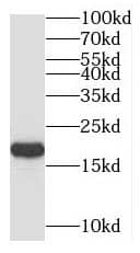 Western Blot UEV2 Antibody - BSA Free