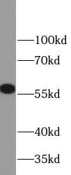 Western Blot MMP23B Antibody - BSA Free