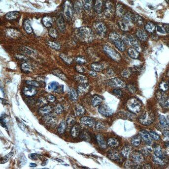 Immunohistochemistry MMP21 Antibody - BSA Free