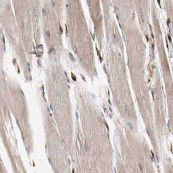 Immunohistochemistry: MMADHC Antibody - BSA Free [NBP3-47083] - Immunohistochemistry of paraffin-embedded human skeletal muscle tissue slide using (MMADHC Antibody) at dilution of 1:200