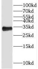 Western Blot: MMADHC Antibody - BSA Free [NBP3-47083] - HeLa cells were subjected to SDS PAGE followed by western blot with (MMADHC Antibody) at dilution of 1:600