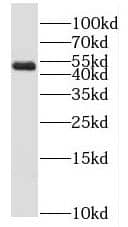 Western Blot MLYCD Antibody - BSA Free