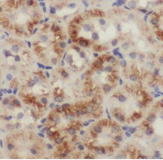 Immunohistochemistry MLYCD Antibody - BSA Free