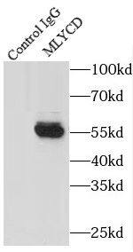 Immunoprecipitation MLYCD Antibody - BSA Free