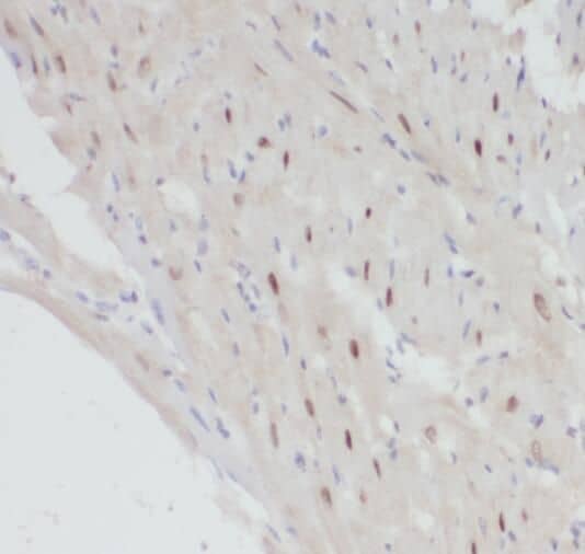 Immunohistochemistry: POLR2J Antibody - BSA Free [NBP3-47090] - Immunohistochemistry of paraffin-embedded human heart using (POLR2J antibody) at dilution of 1:100