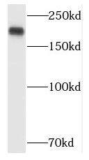 Western Blot: POLR1A Antibody - BSA Free [NBP3-47093] - HeLa cells were subjected to SDS PAGE followed by western blot with (POLR1A antibody) at dilution of 1:1000