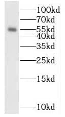 Western Blot DNA polymerase mu Antibody - BSA Free