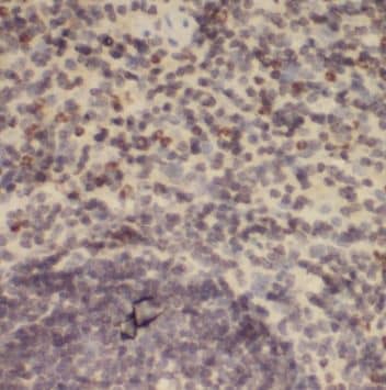 Immunohistochemistry: DNA polymerase mu Antibody - BSA Free [NBP3-47094] - Immunohistochemistry of paraffin-embedded human spleen using (DNA polymerase mu antibody) at dilution of 1:50