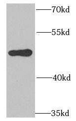 Western Blot: POLD3 Antibody - BSA Free [NBP3-47097] - MCF-7 cells were subjected to SDS PAGE followed by western blot with ( POLD3 Antibody) at dilution of 1:1000