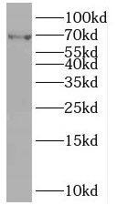 Western Blot POF1B Antibody - BSA Free